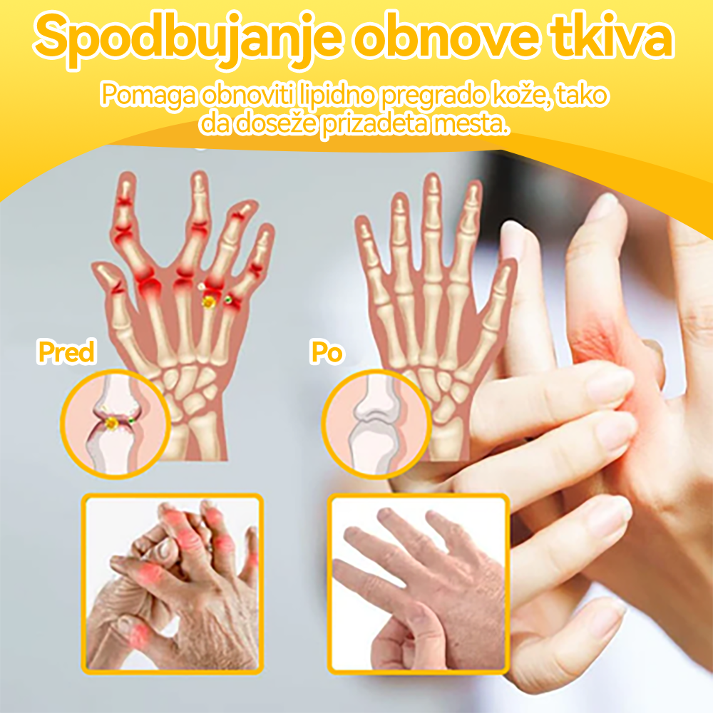 [✅Uradna trgovina]:𝐒𝐩𝐳𝐯™🌏🌏Č𝐞𝐛𝐞𝐥𝐣𝐢 𝐒𝐭𝐫𝐮𝐩 𝐒𝐤𝐥𝐞𝐩𝐢 & 𝐊𝐨𝐬𝐭𝐢 𝐙𝐝𝐫𝐚𝐯𝐥𝐣𝐞𝐧𝐣𝐞 𝐊𝐫𝐞𝐦𝐚 🐝(𝐢𝐳𝐯𝐥𝐞č𝐞𝐤 𝐧𝐨𝐯𝐨𝐳𝐞𝐥𝐚𝐧𝐝𝐬𝐤𝐢𝐡 č𝐞𝐛𝐞𝐥 𝐣𝐞 𝐬𝐩𝐞𝐜𝐢𝐚𝐥𝐢𝐳𝐢𝐫𝐚𝐧 𝐳𝐚 𝐨𝐫𝐭𝐨𝐩𝐞𝐝𝐬𝐤𝐞 𝐛𝐨𝐥𝐞𝐳𝐧𝐢 𝐢𝐧 𝐛𝐨𝐥𝐞č𝐢𝐧𝐞 𝐩𝐫𝐢 𝐚𝐫𝐭𝐫𝐢𝐭𝐢𝐬𝐮)