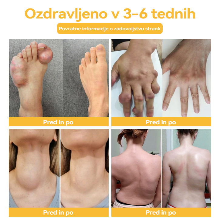 🐝👩‍🔬𝐅𝐥𝐨𝐫𝐢𝐬𝐦𝐚®Č𝐞𝐛𝐞𝐥𝐣𝐢 𝐒𝐭𝐫𝐮𝐩 𝐈𝐧 𝐊𝐮𝐫𝐤𝐮𝐦𝐚 𝐊𝐫𝐞𝐦𝐚 𝐙𝐚 𝐓𝐞𝐫𝐚𝐩𝐢𝐣𝐨 𝐀𝐫𝐭𝐫𝐢𝐭𝐢𝐬𝐚🐝(Š𝐩𝐞𝐜𝐢á𝐥𝐧𝐞 𝐩𝐫𝐞 𝐬𝐭𝐚𝐫ší𝐜𝐡 𝐝𝐨𝐬𝐩𝐞𝐥ý𝐜𝐡)