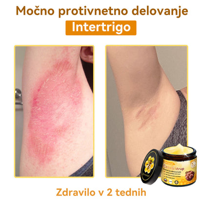 [💯 Brez bolečin-Brez stranskih učinkov] 𝐃𝐨𝐫𝐦𝐨𝐫𝐧𝐚®💥💥Č𝐞𝐛𝐞𝐥𝐣𝐢 𝐬𝐭𝐫𝐮𝐩 𝐊𝐫𝐞𝐦𝐚 𝐳𝐚 𝐨𝐛𝐧𝐨𝐯𝐨 𝐤𝐨ž𝐞- ZADNJI DAN 70% CENEJE
