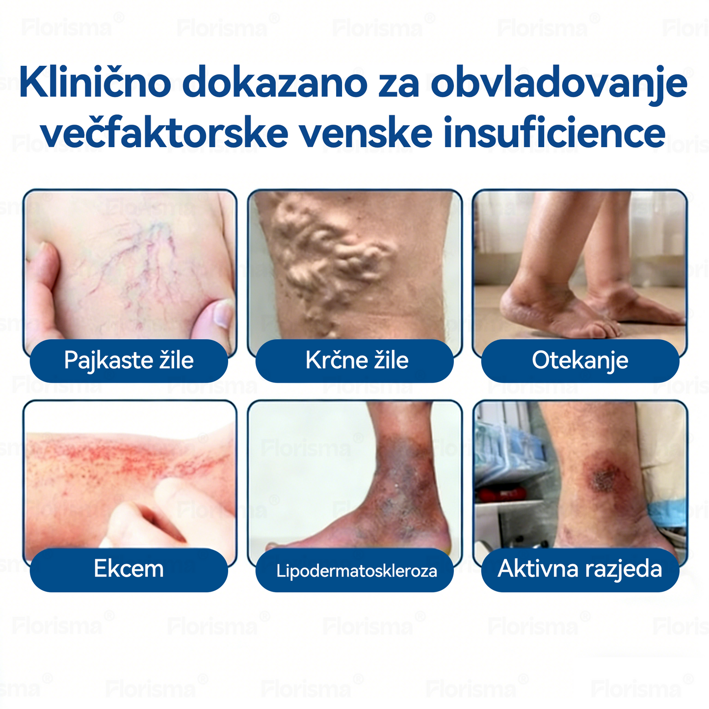 🛡️ 𝐅𝐋𝐎𝐑𝐈𝐒𝐌𝐀® 👩‍⚕️🍉𝐃𝐈𝐎𝐒𝐌𝐈𝐍 𝐈𝐍 𝐇𝐄𝐒𝐏𝐄𝐑𝐈𝐃𝐈𝐍 𝐌𝐢𝐤𝐫𝐨𝐢𝐠𝐞𝐥𝐧𝐢 𝐨𝐛𝐥𝐢ž 𝐬 𝐤𝐥𝐢𝐧𝐢č𝐧𝐨 𝐩𝐫𝐞𝐢𝐳𝐤𝐮š𝐞𝐧𝐨 𝐟𝐨𝐫𝐦𝐮𝐥𝐨 — 𝐍𝐚𝐩𝐫𝐞𝐝𝐧𝐚 𝐳𝐞𝐥𝐢šč𝐧𝐚 𝐦𝐞š𝐚𝐧𝐢𝐜𝐚 𝐳𝐚 𝐨𝐝𝐩𝐫𝐚𝐯𝐥𝐣𝐚𝐧𝐣𝐞 𝐩𝐚𝐣𝐤𝐚𝐬𝐭𝐢𝐡 𝐯𝐞𝐧 𝐢𝐧 𝐥𝐚𝐣š𝐚𝐧𝐣𝐞 𝐭𝐞ž𝐤𝐢𝐡, 𝐮𝐭𝐫𝐮𝐣𝐞𝐧𝐢𝐡 𝐧𝐨𝐠