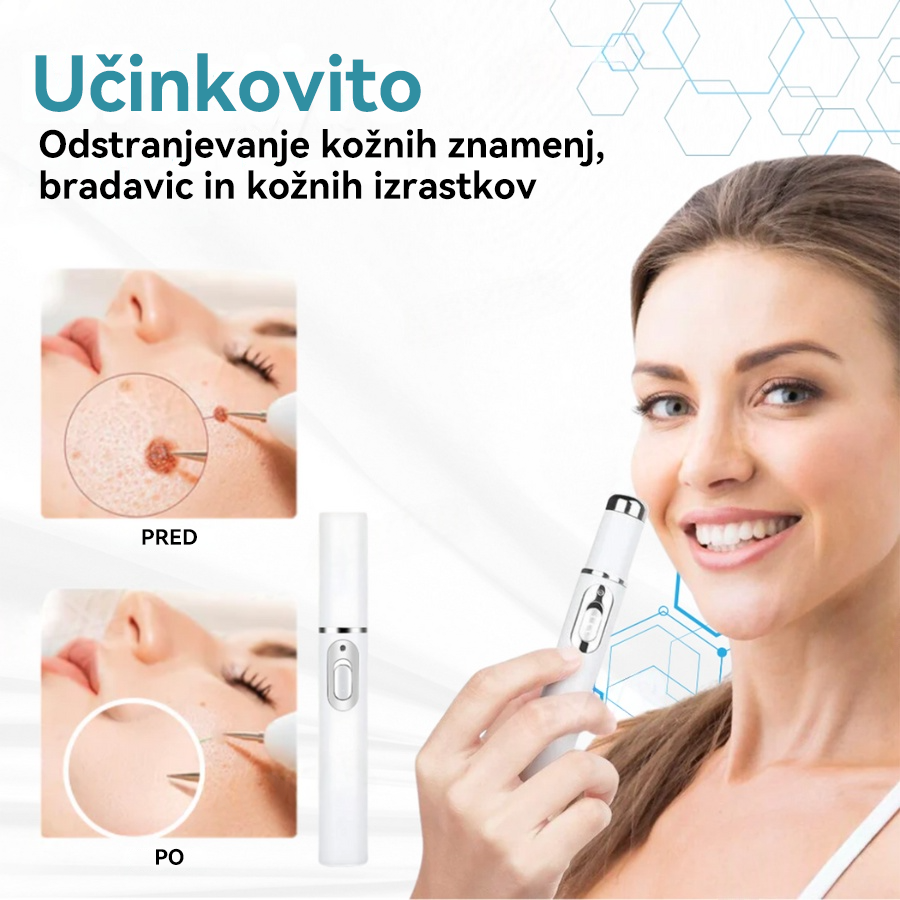 𝐉𝐚𝐬𝐬𝐞𝐞𝐦® Medicinski laserski pisalo 💕 (Poganja ga CO₂ laserska tehnologija – učinkovito odstranjuje znamenja, bradavice, kožne izrastke, pigmentne madeže in druge kožne nepravilnosti) 🔥