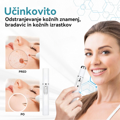 𝐉𝐚𝐬𝐬𝐞𝐞𝐦® Medicinski laserski pisalo 💕 (Poganja ga CO₂ laserska tehnologija – učinkovito odstranjuje znamenja, bradavice, kožne izrastke, pigmentne madeže in druge kožne nepravilnosti) 🔥