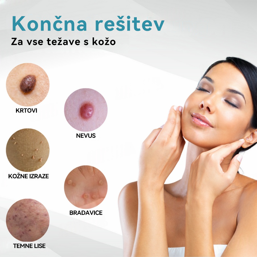 𝐉𝐚𝐬𝐬𝐞𝐞𝐦® Medicinski laserski pisalo 💕 (Poganja ga CO₂ laserska tehnologija – učinkovito odstranjuje znamenja, bradavice, kožne izrastke, pigmentne madeže in druge kožne nepravilnosti) 🔥