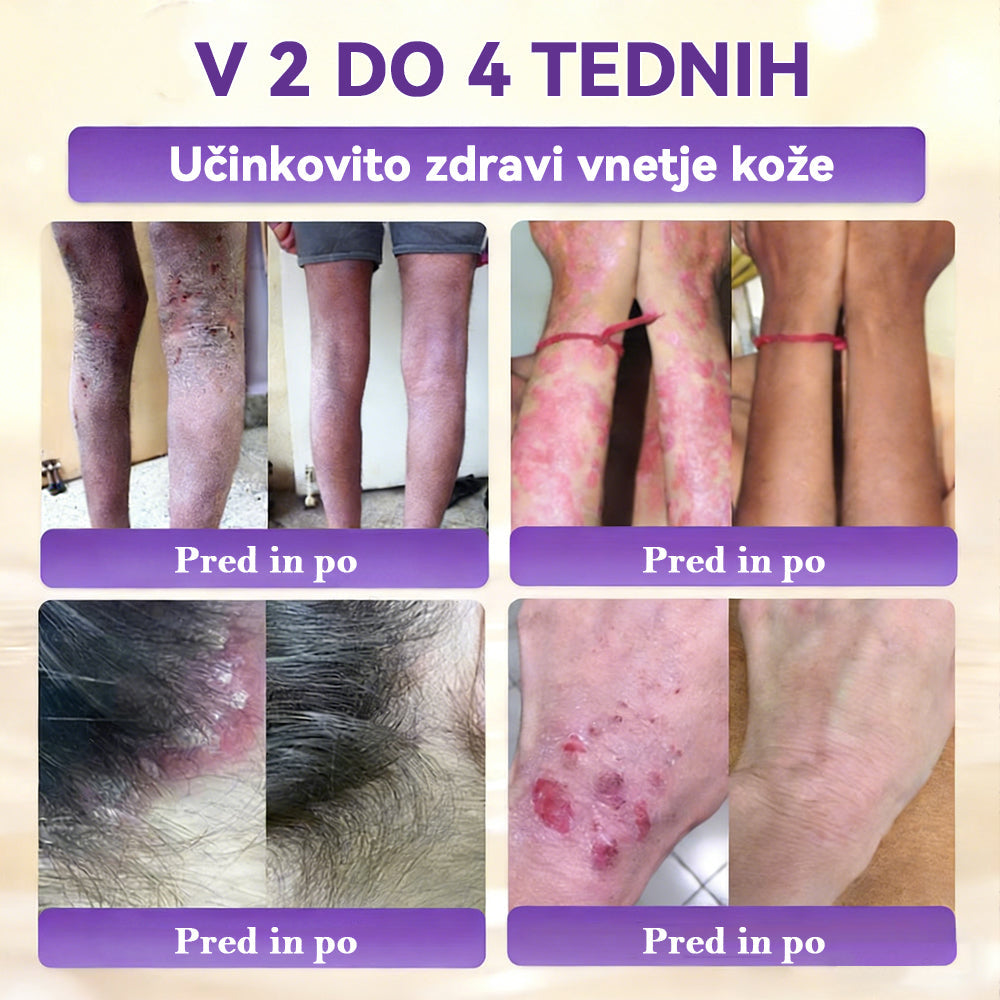 Izdelano v Sloveniji in dostavljeno iz Slovenije. 👩‍⚕️🍉𝐆𝐥𝐢𝐦𝐦𝐞𝐫𝐥𝐲®𝐁𝐢𝐨𝐭𝐢𝐧 𝟏𝟎-𝐕-𝟏 𝐊𝐫𝐞𝐦𝐚 𝐙𝐚 𝐎𝐛𝐧𝐨𝐯𝐨 𝐊𝐨ž𝐞🔥
