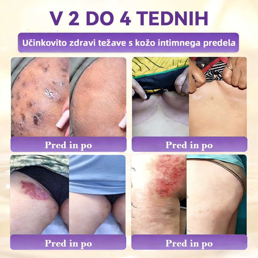 Izdelano v Sloveniji in dostavljeno iz Slovenije. 👩‍⚕️🍉𝐆𝐥𝐢𝐦𝐦𝐞𝐫𝐥𝐲®𝐁𝐢𝐨𝐭𝐢𝐧 𝟏𝟎-𝐕-𝟏 𝐊𝐫𝐞𝐦𝐚 𝐙𝐚 𝐎𝐛𝐧𝐨𝐯𝐨 𝐊𝐨ž𝐞🔥