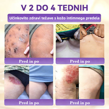 Izdelano v Sloveniji in dostavljeno iz Slovenije. 👩‍⚕️🍉𝐆𝐥𝐢𝐦𝐦𝐞𝐫𝐥𝐲®𝐁𝐢𝐨𝐭𝐢𝐧 𝟏𝟎-𝐕-𝟏 𝐊𝐫𝐞𝐦𝐚 𝐙𝐚 𝐎𝐛𝐧𝐨𝐯𝐨 𝐊𝐨ž𝐞🔥