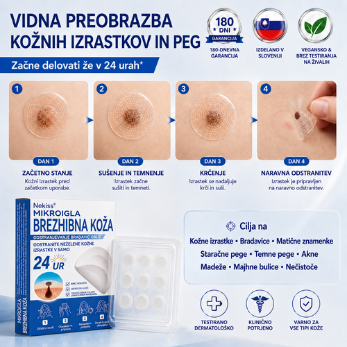 👩‍⚕️🎁𝑼𝒓𝒂𝒅𝒏𝒂 𝒕𝒓𝒈𝒐𝒗𝒊𝒏𝒂 | 𝑵𝐞𝒌𝐢𝐬𝐬® 🌿 𝑴𝒊𝒌𝒓𝒐𝒊𝒈𝒍𝒂 𝑩𝒓𝒆𝒛𝒉𝒊𝒃𝒏𝒂 𝑲𝒐ž𝒂 𝑶𝒅𝒔𝒕𝒓𝒂𝒏𝒋𝒆𝒗𝒂𝒏𝒋𝒆 𝑩𝒓𝒂𝒅𝒂𝒗𝒊𝒄 𝑶𝒃𝒍𝒊ž (𝒁𝒂 𝒌𝒐ž𝒏𝒆 𝒊𝒛𝒓𝒂𝒔𝒕𝒌𝒆, 𝒎𝒂𝒋𝒉𝒏𝒆 𝒌𝒐ž𝒏𝒆 𝒔𝒑𝒓𝒆𝒎𝒆𝒎𝒃𝒆, 𝒃𝒓𝒂𝒅𝒂𝒗𝒊𝒄𝒆, 𝒛𝒏𝒂𝒎𝒆𝒏𝒋𝒂, 𝒔𝒕𝒂𝒓𝒐𝒔𝒕𝒏𝒆 𝒑𝒆𝒈𝒆 𝒊𝒏 𝒕𝒆ž𝒂𝒗𝒆 𝒔 𝒑𝒊𝒈𝒎𝒆𝒏𝒕𝒂𝒄𝒊𝒋𝒐)