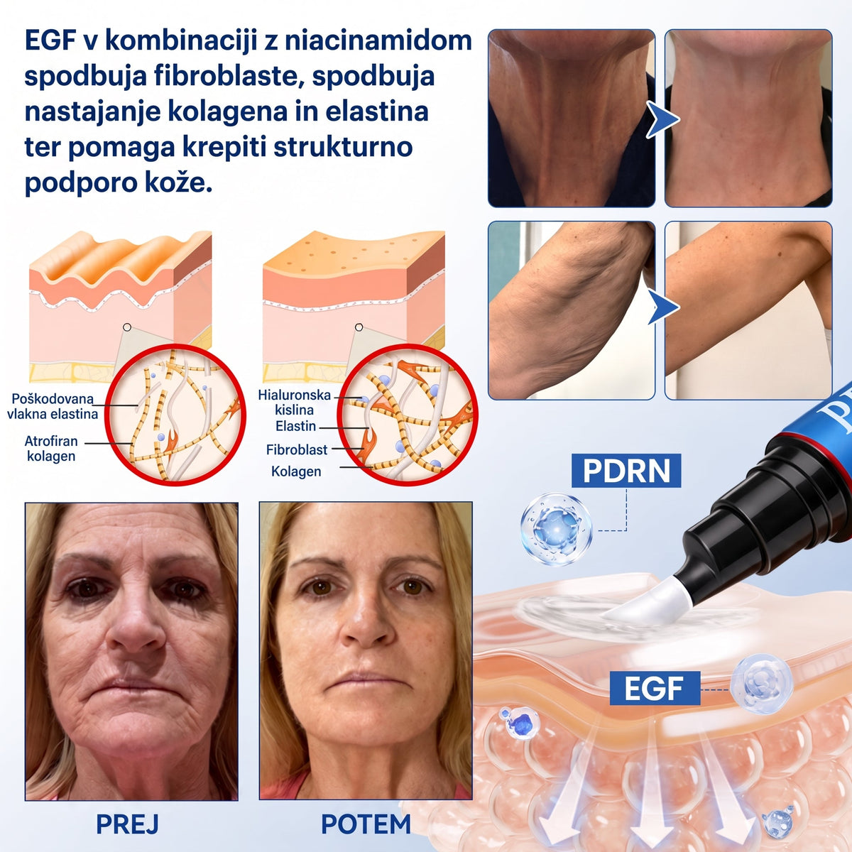 𝑮𝒂𝒇𝒂𝒄𝒆® 👨‍⚕️✨ 𝑃𝐷𝑅𝑁 𝐾𝑅𝐸𝑀𝐴 𝑃𝑅𝑂𝑇𝐼 𝐺𝑈𝐵𝐴𝑀 𝐼𝑁 𝑍𝐴 𝑈Č𝑉𝑅𝑆𝑇𝐼𝑇𝐸𝑉 𝐾𝑂Ž𝐸