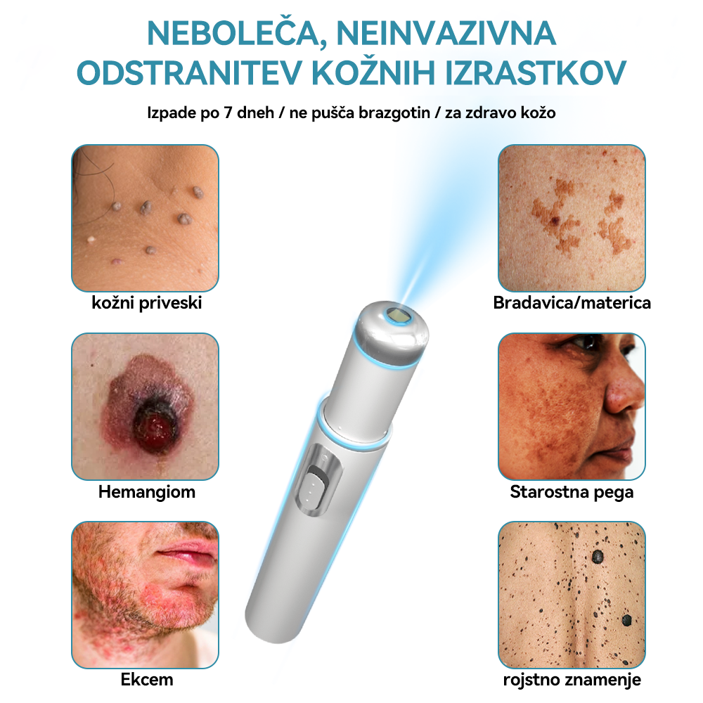 𝐉𝐚𝐬𝐬𝐞𝐞𝐦® Medicinski laserski pisalo 💕 (Poganja ga CO₂ laserska tehnologija – učinkovito odstranjuje znamenja, bradavice, kožne izrastke, pigmentne madeže in druge kožne nepravilnosti) 🔥