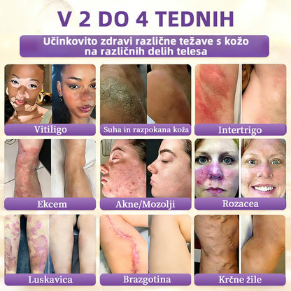 Izdelano v Sloveniji in dostavljeno iz Slovenije. 👩‍⚕️🍉𝐆𝐥𝐢𝐦𝐦𝐞𝐫𝐥𝐲®𝐁𝐢𝐨𝐭𝐢𝐧 𝟏𝟎-𝐕-𝟏 𝐊𝐫𝐞𝐦𝐚 𝐙𝐚 𝐎𝐛𝐧𝐨𝐯𝐨 𝐊𝐨ž𝐞🔥