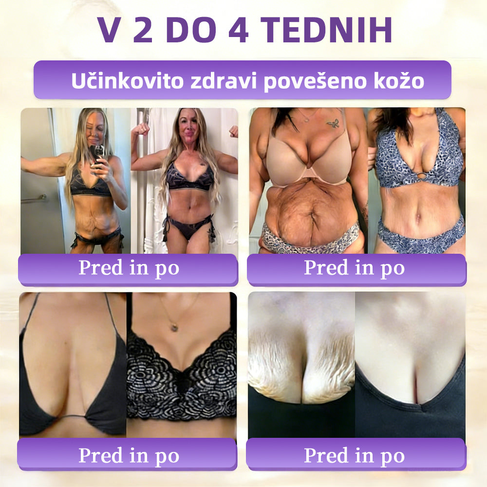 Izdelano v Sloveniji in dostavljeno iz Slovenije. 👩‍⚕️🍉𝐆𝐥𝐢𝐦𝐦𝐞𝐫𝐥𝐲®𝐁𝐢𝐨𝐭𝐢𝐧 𝟏𝟎-𝐕-𝟏 𝐊𝐫𝐞𝐦𝐚 𝐙𝐚 𝐎𝐛𝐧𝐨𝐯𝐨 𝐊𝐨ž𝐞🔥