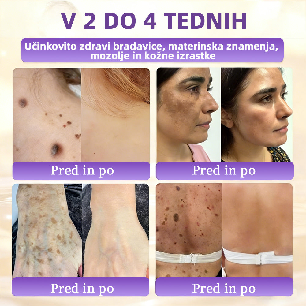 Izdelano v Sloveniji in dostavljeno iz Slovenije. 👩‍⚕️🍉𝐆𝐥𝐢𝐦𝐦𝐞𝐫𝐥𝐲®𝐁𝐢𝐨𝐭𝐢𝐧 𝟏𝟎-𝐕-𝟏 𝐊𝐫𝐞𝐦𝐚 𝐙𝐚 𝐎𝐛𝐧𝐨𝐯𝐨 𝐊𝐨ž𝐞🔥