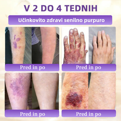 Izdelano v Sloveniji in dostavljeno iz Slovenije. 👩‍⚕️🍉𝐆𝐥𝐢𝐦𝐦𝐞𝐫𝐥𝐲®𝐁𝐢𝐨𝐭𝐢𝐧 𝟏𝟎-𝐕-𝟏 𝐊𝐫𝐞𝐦𝐚 𝐙𝐚 𝐎𝐛𝐧𝐨𝐯𝐨 𝐊𝐨ž𝐞🔥