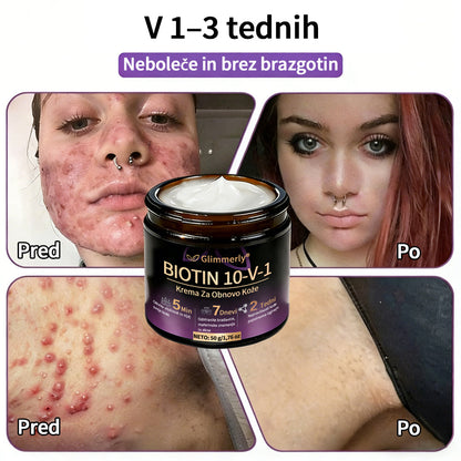 Izdelano v Sloveniji in dostavljeno iz Slovenije. 👩‍⚕️🍉𝐆𝐥𝐢𝐦𝐦𝐞𝐫𝐥𝐲®𝐁𝐢𝐨𝐭𝐢𝐧 𝟏𝟎-𝐕-𝟏 𝐊𝐫𝐞𝐦𝐚 𝐙𝐚 𝐎𝐛𝐧𝐨𝐯𝐨 𝐊𝐨ž𝐞🔥