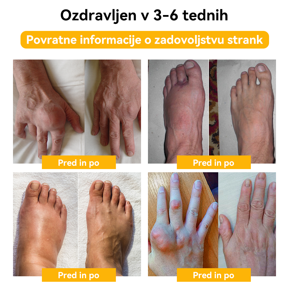 [✅Uradna trgovina]:𝐒𝐩𝐳𝐯™🌏🌏Č𝐞𝐛𝐞𝐥𝐣𝐢 𝐒𝐭𝐫𝐮𝐩 𝐒𝐤𝐥𝐞𝐩𝐢 & 𝐊𝐨𝐬𝐭𝐢 𝐙𝐝𝐫𝐚𝐯𝐥𝐣𝐞𝐧𝐣𝐞 𝐊𝐫𝐞𝐦𝐚 🐝(𝐢𝐳𝐯𝐥𝐞č𝐞𝐤 𝐧𝐨𝐯𝐨𝐳𝐞𝐥𝐚𝐧𝐝𝐬𝐤𝐢𝐡 č𝐞𝐛𝐞𝐥 𝐣𝐞 𝐬𝐩𝐞𝐜𝐢𝐚𝐥𝐢𝐳𝐢𝐫𝐚𝐧 𝐳𝐚 𝐨𝐫𝐭𝐨𝐩𝐞𝐝𝐬𝐤𝐞 𝐛𝐨𝐥𝐞𝐳𝐧𝐢 𝐢𝐧 𝐛𝐨𝐥𝐞č𝐢𝐧𝐞 𝐩𝐫𝐢 𝐚𝐫𝐭𝐫𝐢𝐭𝐢𝐬𝐮)
