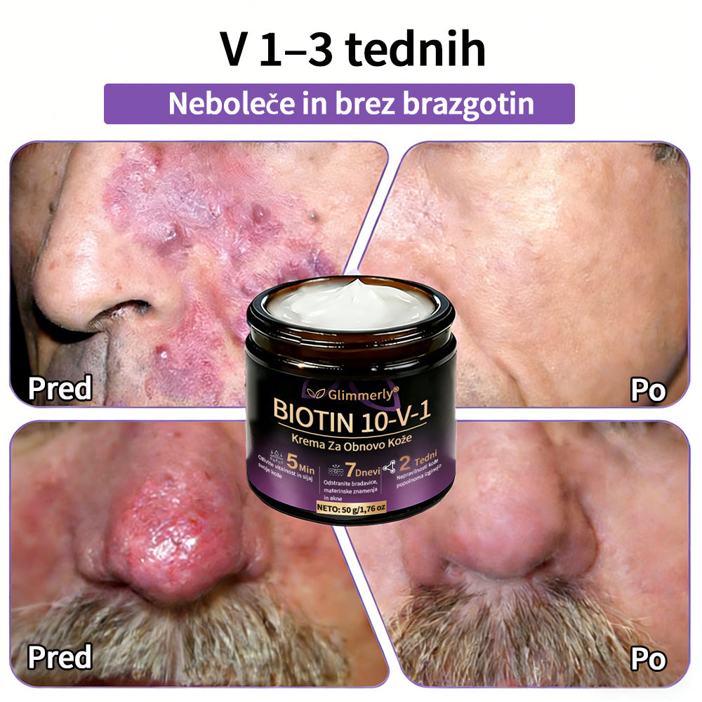 Izdelano v Sloveniji in dostavljeno iz Slovenije. 👩‍⚕️🍉𝐆𝐥𝐢𝐦𝐦𝐞𝐫𝐥𝐲®𝐁𝐢𝐨𝐭𝐢𝐧 𝟏𝟎-𝐕-𝟏 𝐊𝐫𝐞𝐦𝐚 𝐙𝐚 𝐎𝐛𝐧𝐨𝐯𝐨 𝐊𝐨ž𝐞🔥