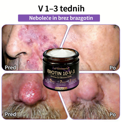 Izdelano v Sloveniji in dostavljeno iz Slovenije. 👩‍⚕️🍉𝐆𝐥𝐢𝐦𝐦𝐞𝐫𝐥𝐲®𝐁𝐢𝐨𝐭𝐢𝐧 𝟏𝟎-𝐕-𝟏 𝐊𝐫𝐞𝐦𝐚 𝐙𝐚 𝐎𝐛𝐧𝐨𝐯𝐨 𝐊𝐨ž𝐞🔥