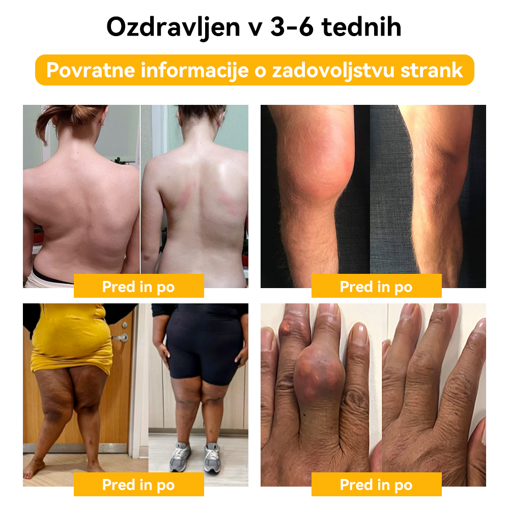 [✅Uradna trgovina]:𝐒𝐩𝐳𝐯™🌏🌏Č𝐞𝐛𝐞𝐥𝐣𝐢 𝐒𝐭𝐫𝐮𝐩 𝐒𝐤𝐥𝐞𝐩𝐢 & 𝐊𝐨𝐬𝐭𝐢 𝐙𝐝𝐫𝐚𝐯𝐥𝐣𝐞𝐧𝐣𝐞 𝐊𝐫𝐞𝐦𝐚 🐝(𝐢𝐳𝐯𝐥𝐞č𝐞𝐤 𝐧𝐨𝐯𝐨𝐳𝐞𝐥𝐚𝐧𝐝𝐬𝐤𝐢𝐡 č𝐞𝐛𝐞𝐥 𝐣𝐞 𝐬𝐩𝐞𝐜𝐢𝐚𝐥𝐢𝐳𝐢𝐫𝐚𝐧 𝐳𝐚 𝐨𝐫𝐭𝐨𝐩𝐞𝐝𝐬𝐤𝐞 𝐛𝐨𝐥𝐞𝐳𝐧𝐢 𝐢𝐧 𝐛𝐨𝐥𝐞č𝐢𝐧𝐞 𝐩𝐫𝐢 𝐚𝐫𝐭𝐫𝐢𝐭𝐢𝐬𝐮)