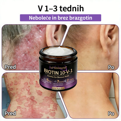 Izdelano v Sloveniji in dostavljeno iz Slovenije. 👩‍⚕️🍉𝐆𝐥𝐢𝐦𝐦𝐞𝐫𝐥𝐲®𝐁𝐢𝐨𝐭𝐢𝐧 𝟏𝟎-𝐕-𝟏 𝐊𝐫𝐞𝐦𝐚 𝐙𝐚 𝐎𝐛𝐧𝐨𝐯𝐨 𝐊𝐨ž𝐞🔥