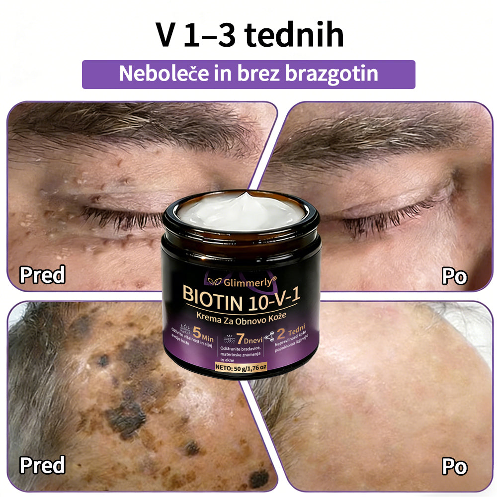 Izdelano v Sloveniji in dostavljeno iz Slovenije. 👩‍⚕️🍉𝐆𝐥𝐢𝐦𝐦𝐞𝐫𝐥𝐲®𝐁𝐢𝐨𝐭𝐢𝐧 𝟏𝟎-𝐕-𝟏 𝐊𝐫𝐞𝐦𝐚 𝐙𝐚 𝐎𝐛𝐧𝐨𝐯𝐨 𝐊𝐨ž𝐞🔥