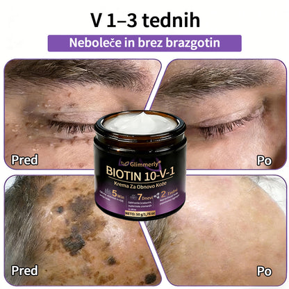 Izdelano v Sloveniji in dostavljeno iz Slovenije. 👩‍⚕️🍉𝐆𝐥𝐢𝐦𝐦𝐞𝐫𝐥𝐲®𝐁𝐢𝐨𝐭𝐢𝐧 𝟏𝟎-𝐕-𝟏 𝐊𝐫𝐞𝐦𝐚 𝐙𝐚 𝐎𝐛𝐧𝐨𝐯𝐨 𝐊𝐨ž𝐞🔥