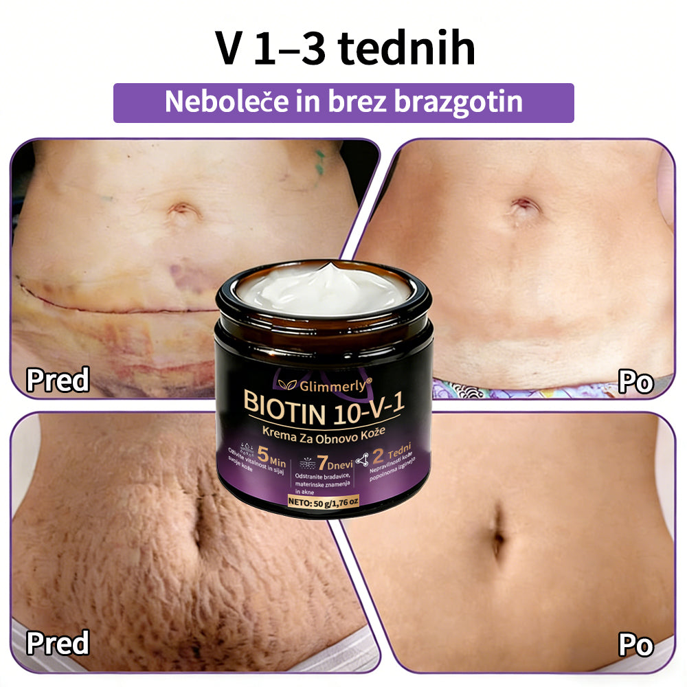 Izdelano v Sloveniji in dostavljeno iz Slovenije. 👩‍⚕️🍉𝐆𝐥𝐢𝐦𝐦𝐞𝐫𝐥𝐲®𝐁𝐢𝐨𝐭𝐢𝐧 𝟏𝟎-𝐕-𝟏 𝐊𝐫𝐞𝐦𝐚 𝐙𝐚 𝐎𝐛𝐧𝐨𝐯𝐨 𝐊𝐨ž𝐞🔥