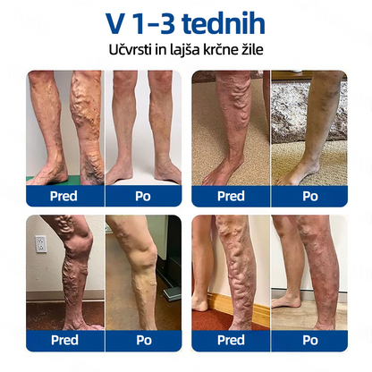 🛡️𝐅𝐥𝐨𝐫𝐢𝐬𝐦𝐚® 💕 Microneedle obliž klinične kakovosti z diosminom in hesperidinom — Napredna zeliščna formula, zasnovana za ciljno delovanje proti pajkastim in krčnim žilam ter za lajšanje občutka težkih in utrujenih nog. 👩‍⚕️