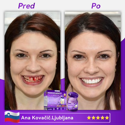 Uradna trgovina 🔥| 𝐷𝑜𝑟𝑚𝑜𝑟𝑛𝑎® 𝐻𝑖𝑑𝑟𝑜𝑘𝑠𝑖𝑎𝑝𝑎𝑡𝑖𝑡 𝑃𝑟𝑎ℎ 𝑧𝑎 𝑜𝑏𝑛𝑜𝑣𝑜 𝑧𝑜𝑏