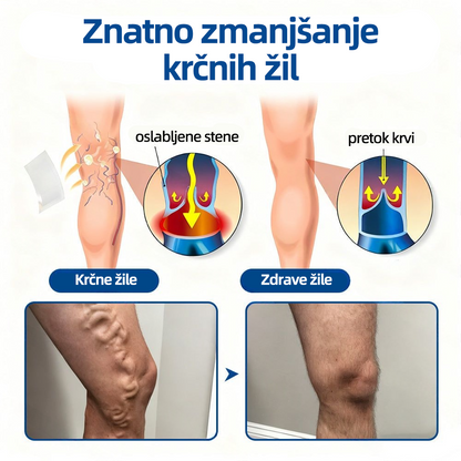 🛡️𝐅𝐥𝐨𝐫𝐢𝐬𝐦𝐚® 💕 Microneedle obliž klinične kakovosti z diosminom in hesperidinom — Napredna zeliščna formula, zasnovana za ciljno delovanje proti pajkastim in krčnim žilam ter za lajšanje občutka težkih in utrujenih nog. 👩‍⚕️
