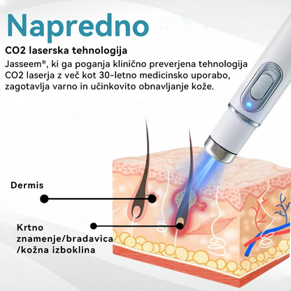 𝐉𝐚𝐬𝐬𝐞𝐞𝐦® Medicinski laserski pisalo 💕 (Poganja ga CO₂ laserska tehnologija – učinkovito odstranjuje znamenja, bradavice, kožne izrastke, pigmentne madeže in druge kožne nepravilnosti) 🔥