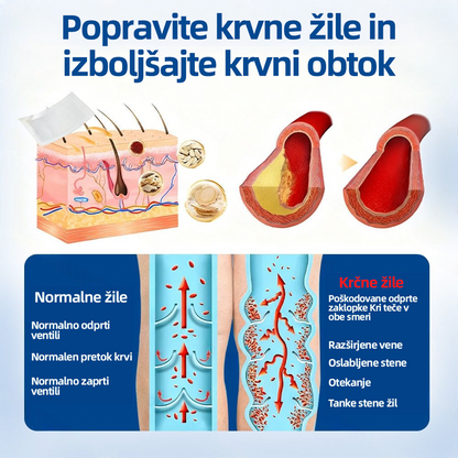 🛡️𝐅𝐥𝐨𝐫𝐢𝐬𝐦𝐚® 💕 Microneedle obliž klinične kakovosti z diosminom in hesperidinom — Napredna zeliščna formula, zasnovana za ciljno delovanje proti pajkastim in krčnim žilam ter za lajšanje občutka težkih in utrujenih nog. 👩‍⚕️
