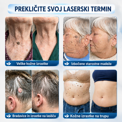 👩‍⚕️🎁𝑼𝒓𝒂𝒅𝒏𝒂 𝒕𝒓𝒈𝒐𝒗𝒊𝒏𝒂 | 𝑵𝐞𝒌𝐢𝐬𝐬® 🌿 𝑴𝒊𝒌𝒓𝒐𝒊𝒈𝒍𝒂 𝑩𝒓𝒆𝒛𝒉𝒊𝒃𝒏𝒂 𝑲𝒐ž𝒂 𝑶𝒅𝒔𝒕𝒓𝒂𝒏𝒋𝒆𝒗𝒂𝒏𝒋𝒆 𝑩𝒓𝒂𝒅𝒂𝒗𝒊𝒄 𝑶𝒃𝒍𝒊ž (𝒁𝒂 𝒌𝒐ž𝒏𝒆 𝒊𝒛𝒓𝒂𝒔𝒕𝒌𝒆, 𝒎𝒂𝒋𝒉𝒏𝒆 𝒌𝒐ž𝒏𝒆 𝒔𝒑𝒓𝒆𝒎𝒆𝒎𝒃𝒆, 𝒃𝒓𝒂𝒅𝒂𝒗𝒊𝒄𝒆, 𝒛𝒏𝒂𝒎𝒆𝒏𝒋𝒂, 𝒔𝒕𝒂𝒓𝒐𝒔𝒕𝒏𝒆 𝒑𝒆𝒈𝒆 𝒊𝒏 𝒕𝒆ž𝒂𝒗𝒆 𝒔 𝒑𝒊𝒈𝒎𝒆𝒏𝒕𝒂𝒄𝒊𝒋𝒐)