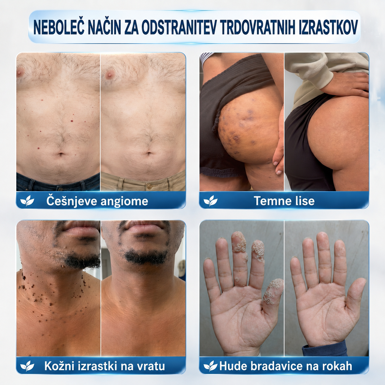 👩‍⚕️🎁𝑼𝒓𝒂𝒅𝒏𝒂 𝒕𝒓𝒈𝒐𝒗𝒊𝒏𝒂 | 𝑵𝐞𝒌𝐢𝐬𝐬® 🌿 𝑴𝒊𝒌𝒓𝒐𝒊𝒈𝒍𝒂 𝑩𝒓𝒆𝒛𝒉𝒊𝒃𝒏𝒂 𝑲𝒐ž𝒂 𝑶𝒅𝒔𝒕𝒓𝒂𝒏𝒋𝒆𝒗𝒂𝒏𝒋𝒆 𝑩𝒓𝒂𝒅𝒂𝒗𝒊𝒄 𝑶𝒃𝒍𝒊ž (𝒁𝒂 𝒌𝒐ž𝒏𝒆 𝒊𝒛𝒓𝒂𝒔𝒕𝒌𝒆, 𝒎𝒂𝒋𝒉𝒏𝒆 𝒌𝒐ž𝒏𝒆 𝒔𝒑𝒓𝒆𝒎𝒆𝒎𝒃𝒆, 𝒃𝒓𝒂𝒅𝒂𝒗𝒊𝒄𝒆, 𝒛𝒏𝒂𝒎𝒆𝒏𝒋𝒂, 𝒔𝒕𝒂𝒓𝒐𝒔𝒕𝒏𝒆 𝒑𝒆𝒈𝒆 𝒊𝒏 𝒕𝒆ž𝒂𝒗𝒆 𝒔 𝒑𝒊𝒈𝒎𝒆𝒏𝒕𝒂𝒄𝒊𝒋𝒐)