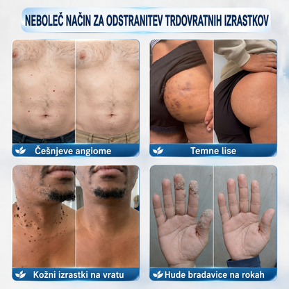 👩‍⚕️🎁𝑼𝒓𝒂𝒅𝒏𝒂 𝒕𝒓𝒈𝒐𝒗𝒊𝒏𝒂 | 𝑵𝐞𝒌𝐢𝐬𝐬® 🌿 𝑴𝒊𝒌𝒓𝒐𝒊𝒈𝒍𝒂 𝑩𝒓𝒆𝒛𝒉𝒊𝒃𝒏𝒂 𝑲𝒐ž𝒂 𝑶𝒅𝒔𝒕𝒓𝒂𝒏𝒋𝒆𝒗𝒂𝒏𝒋𝒆 𝑩𝒓𝒂𝒅𝒂𝒗𝒊𝒄 𝑶𝒃𝒍𝒊ž (𝒁𝒂 𝒌𝒐ž𝒏𝒆 𝒊𝒛𝒓𝒂𝒔𝒕𝒌𝒆, 𝒎𝒂𝒋𝒉𝒏𝒆 𝒌𝒐ž𝒏𝒆 𝒔𝒑𝒓𝒆𝒎𝒆𝒎𝒃𝒆, 𝒃𝒓𝒂𝒅𝒂𝒗𝒊𝒄𝒆, 𝒛𝒏𝒂𝒎𝒆𝒏𝒋𝒂, 𝒔𝒕𝒂𝒓𝒐𝒔𝒕𝒏𝒆 𝒑𝒆𝒈𝒆 𝒊𝒏 𝒕𝒆ž𝒂𝒗𝒆 𝒔 𝒑𝒊𝒈𝒎𝒆𝒏𝒕𝒂𝒄𝒊𝒋𝒐)