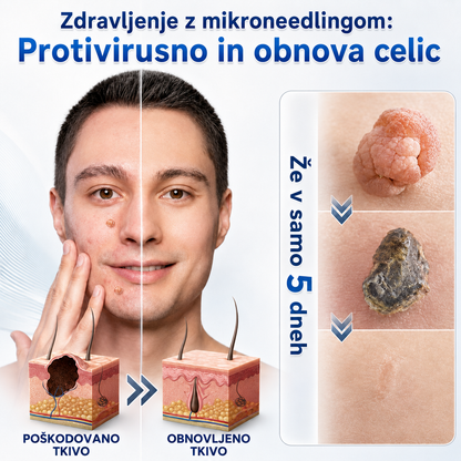 👩‍⚕️🎁𝑼𝒓𝒂𝒅𝒏𝒂 𝒕𝒓𝒈𝒐𝒗𝒊𝒏𝒂 | 𝑵𝐞𝒌𝐢𝐬𝐬® 🌿 𝑴𝒊𝒌𝒓𝒐𝒊𝒈𝒍𝒂 𝑩𝒓𝒆𝒛𝒉𝒊𝒃𝒏𝒂 𝑲𝒐ž𝒂 𝑶𝒅𝒔𝒕𝒓𝒂𝒏𝒋𝒆𝒗𝒂𝒏𝒋𝒆 𝑩𝒓𝒂𝒅𝒂𝒗𝒊𝒄 𝑶𝒃𝒍𝒊ž (𝒁𝒂 𝒌𝒐ž𝒏𝒆 𝒊𝒛𝒓𝒂𝒔𝒕𝒌𝒆, 𝒎𝒂𝒋𝒉𝒏𝒆 𝒌𝒐ž𝒏𝒆 𝒔𝒑𝒓𝒆𝒎𝒆𝒎𝒃𝒆, 𝒃𝒓𝒂𝒅𝒂𝒗𝒊𝒄𝒆, 𝒛𝒏𝒂𝒎𝒆𝒏𝒋𝒂, 𝒔𝒕𝒂𝒓𝒐𝒔𝒕𝒏𝒆 𝒑𝒆𝒈𝒆 𝒊𝒏 𝒕𝒆ž𝒂𝒗𝒆 𝒔 𝒑𝒊𝒈𝒎𝒆𝒏𝒕𝒂𝒄𝒊𝒋𝒐)