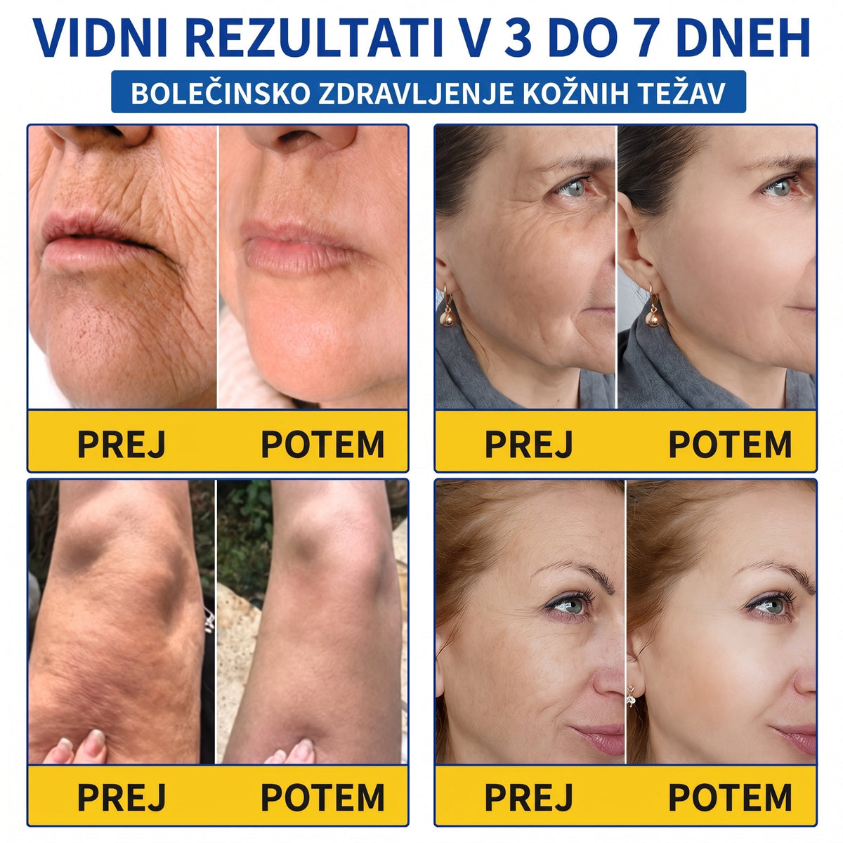 𝑮𝒂𝒇𝒂𝒄𝒆® 👨‍⚕️✨ 𝑃𝐷𝑅𝑁 𝐾𝑅𝐸𝑀𝐴 𝑃𝑅𝑂𝑇𝐼 𝐺𝑈𝐵𝐴𝑀 𝐼𝑁 𝑍𝐴 𝑈Č𝑉𝑅𝑆𝑇𝐼𝑇𝐸𝑉 𝐾𝑂Ž𝐸